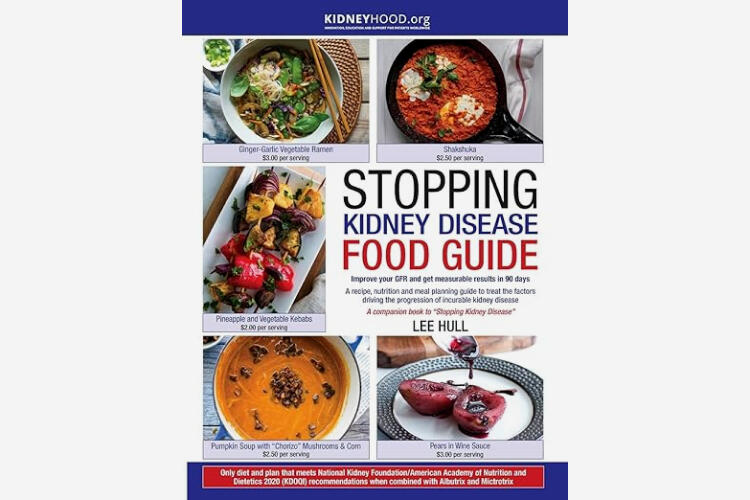 Fancy Chocolates Image of an open chocolate box